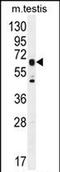 DNAAF3 antibody, PA5-71524, Invitrogen Antibodies, Western Blot image 