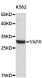 VAMP Associated Protein A antibody, STJ26070, St John