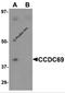 Coiled-Coil Domain Containing 69 antibody, 5691, ProSci, Western Blot image 
