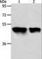 Acyl-CoA Thioesterase 9 antibody, LS-C401173, Lifespan Biosciences, Western Blot image 