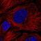 HPS4 Biogenesis Of Lysosomal Organelles Complex 3 Subunit 2 antibody, NBP2-31898, Novus Biologicals, Immunofluorescence image 