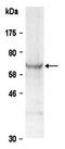 Protein Inhibitor Of Activated STAT 3 antibody, orb66717, Biorbyt, Western Blot image 