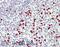 Peptidyl Arginine Deiminase 4 antibody, 46-126, ProSci, Immunohistochemistry paraffin image 