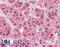 PARP2 antibody, LS-B3239, Lifespan Biosciences, Immunohistochemistry frozen image 