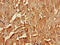 Clathrin Heavy Chain Like 1 antibody, CSB-PA005594LA01HU, Cusabio, Immunohistochemistry paraffin image 