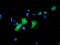 Carnosine Dipeptidase 2 antibody, MA5-25702, Invitrogen Antibodies, Immunocytochemistry image 