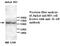 Interleukin 6 Receptor antibody, MBS416532, MyBioSource, Western Blot image 