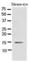 Cellular Retinoic Acid Binding Protein 1 antibody, GTX50013, GeneTex, Western Blot image 