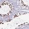 SURP And G-Patch Domain Containing 2 antibody, NBP2-38906, Novus Biologicals, Immunohistochemistry frozen image 