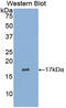 LIF Receptor Subunit Alpha antibody, LS-C295159, Lifespan Biosciences, Western Blot image 