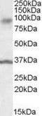 Ankyrin repeat and protein kinase domain-containing protein 1 antibody, GTX88578, GeneTex, Western Blot image 