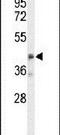 Olfactomedin Like 3 antibody, PA5-26446, Invitrogen Antibodies, Western Blot image 