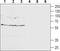 Gamma-Aminobutyric Acid Type A Receptor Delta Subunit antibody, TA328816, Origene, Western Blot image 