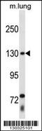 Thyroid Hormone Receptor Associated Protein 3 antibody, 58-507, ProSci, Western Blot image 