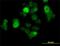 SRY-Box 30 antibody, H00011063-M02, Novus Biologicals, Immunocytochemistry image 