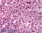 Melanoma-associated antigen 9 antibody, LS-B887, Lifespan Biosciences, Immunohistochemistry frozen image 