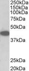 Tribbles Pseudokinase 1 antibody, EB11105, Everest Biotech, Western Blot image 