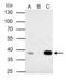 Cyclin Dependent Kinase 7 antibody, GTX111919, GeneTex, Immunoprecipitation image 