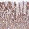 Chromodomain Helicase DNA Binding Protein 9 antibody, NBP2-48933, Novus Biologicals, Immunohistochemistry frozen image 