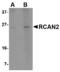 Regulator Of Calcineurin 2 antibody, MBS151578, MyBioSource, Western Blot image 