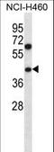 Pseudouridine Synthase 1 antibody, LS-C162327, Lifespan Biosciences, Western Blot image 