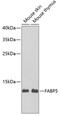 FABP5 antibody, 22-169, ProSci, Western Blot image 