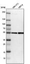 Monoamine Oxidase B antibody, NBP1-87493, Novus Biologicals, Western Blot image 