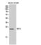 RAS Like Family 10 Member A antibody, PA5-51054, Invitrogen Antibodies, Western Blot image 