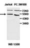 Homogentisate 1,2-Dioxygenase antibody, orb77692, Biorbyt, Western Blot image 