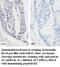 Mucin 16, Cell Surface Associated antibody, MBS416125, MyBioSource, Immunohistochemistry frozen image 