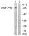 Transferrin Receptor antibody, A30443, Boster Biological Technology, Western Blot image 