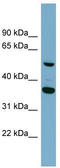 ADAM Like Decysin 1 antibody, TA334544, Origene, Western Blot image 