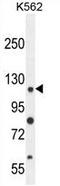 Ankyrin Repeat Domain 52 antibody, AP50197PU-N, Origene, Western Blot image 