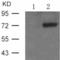 Activating Transcription Factor 2 antibody, TA324219, Origene, Western Blot image 