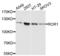 Receptor Tyrosine Kinase Like Orphan Receptor 1 antibody, LS-C332485, Lifespan Biosciences, Western Blot image 