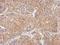 Phosphodiesterase 10A antibody, NBP2-19742, Novus Biologicals, Immunohistochemistry paraffin image 