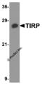 Toll Like Receptor Adaptor Molecule 2 antibody, 3206, ProSci, Western Blot image 