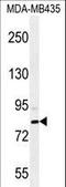 SET And MYND Domain Containing 4 antibody, LS-C161333, Lifespan Biosciences, Western Blot image 