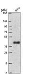 TLE Family Member 4, Transcriptional Corepressor antibody, NBP2-55862, Novus Biologicals, Western Blot image 