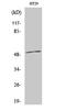 Beta-1 adrenergic receptor antibody, STJ91724, St John