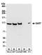 Phosphoribosylglycinamide Formyltransferase, Phosphoribosylglycinamide Synthetase, Phosphoribosylaminoimidazole Synthetase antibody, A304-312A, Bethyl Labs, Western Blot image 