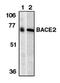 BCL2 Interacting Protein 3 Like antibody, orb108722, Biorbyt, Western Blot image 