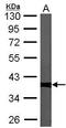 Serine/threonine-protein phosphatase PP1-gamma catalytic subunit antibody, GTX105618, GeneTex, Western Blot image 