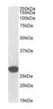 Snail Family Transcriptional Repressor 1 antibody, orb372994, Biorbyt, Western Blot image 