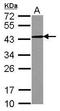 CD82 Molecule antibody, GTX100633, GeneTex, Western Blot image 