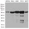 Protein Phosphatase 3 Catalytic Subunit Alpha antibody, TA810584S, Origene, Western Blot image 