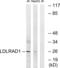 Low Density Lipoprotein Receptor Class A Domain Containing 1 antibody, LS-C120067, Lifespan Biosciences, Western Blot image 