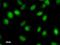 Forkhead Box M1 antibody, LS-C342613, Lifespan Biosciences, Immunofluorescence image 