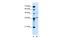 Armadillo Repeat Containing X-Linked 6 antibody, A18132, Boster Biological Technology, Western Blot image 