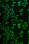 ST3 Beta-Galactoside Alpha-2,3-Sialyltransferase 4 antibody, GTX54730, GeneTex, Immunofluorescence image 